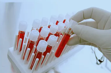 在香港，哪家实验室做性别鉴定血液测试最好？它真的准确吗？