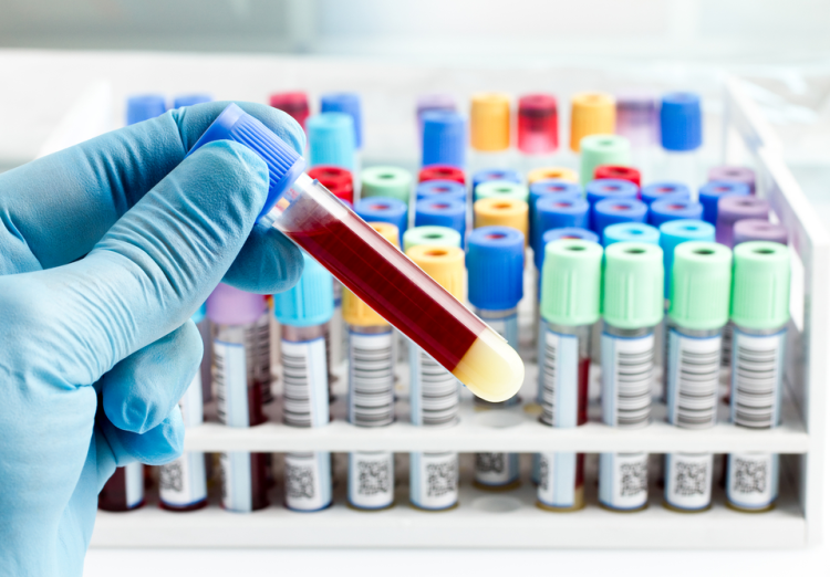 深圳高龄供卵公司：男性和女性的专业血液测试