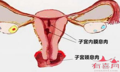 惠州助孕中介信息：宫颈息肉手术后应注意哪些事项